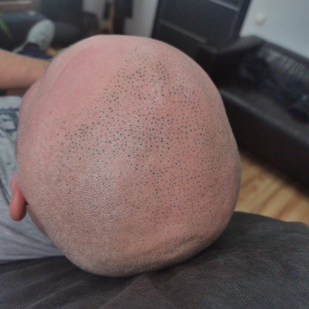 Плохая трихопигментация от другого мастера