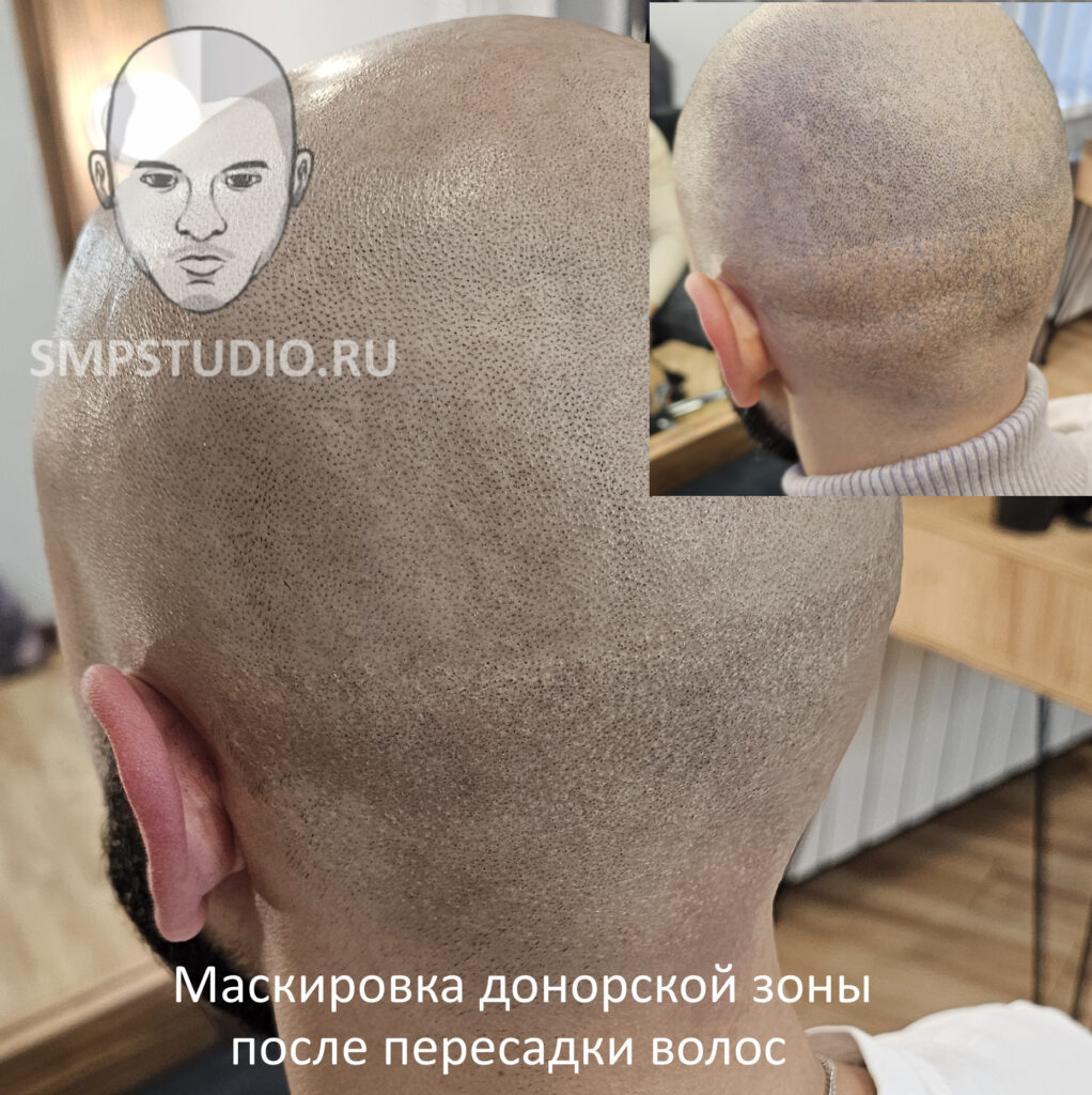 Трихопигментация волос smpstudio.ru Краснодар scalpmicropigmentation