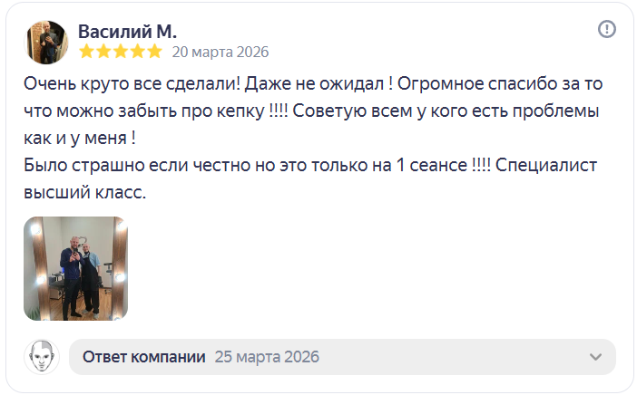 Трихопигментация волос отзыв Краснодар — scalp micropigmentation